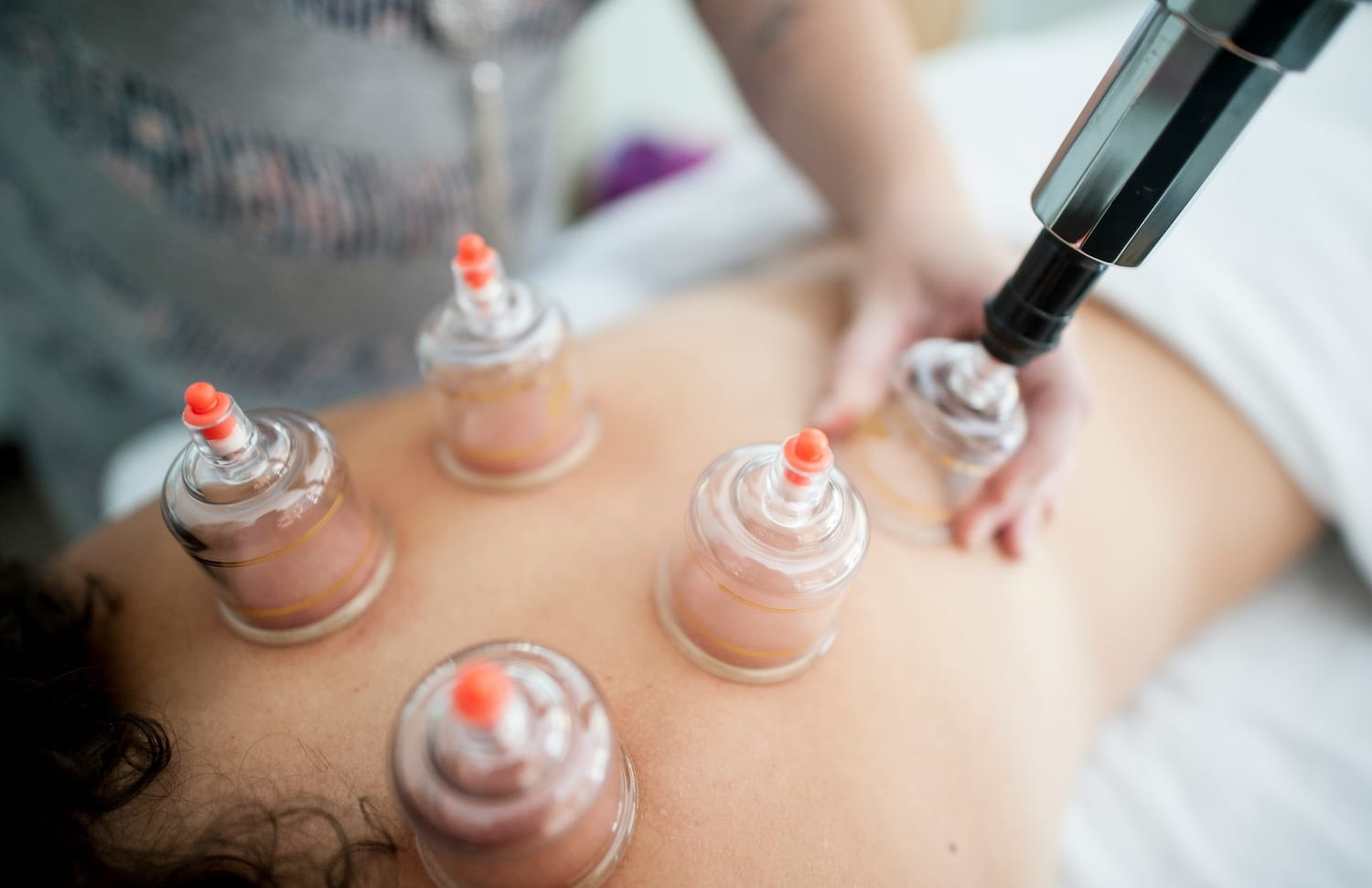 cupping winnipeg