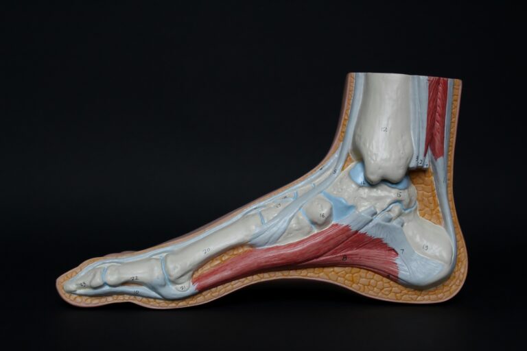 Posterior Tibial Tendon Dysfunction (PTTD): Causes & Treatment
